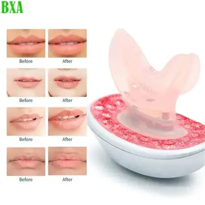 LED Lip Therapy Device