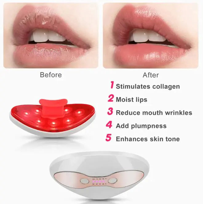 LED Lip Therapy Device